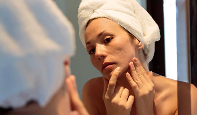 Facial Scars: How Long Does a Scar Take to Heal on Your Face