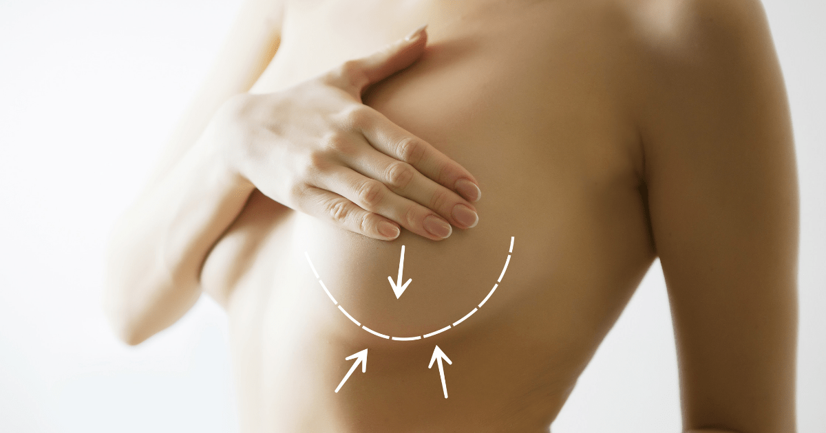 Do Breast Lift Scars Go Away?