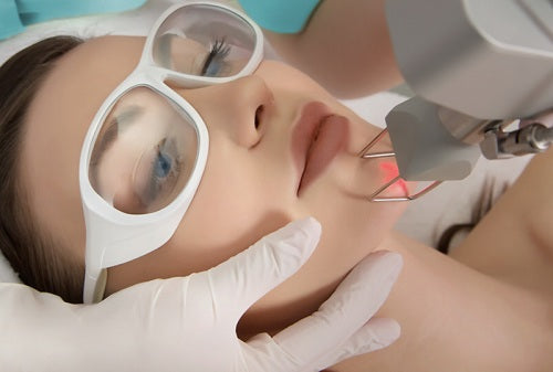 Laser Skin Resurfacing: Different Types of Lasers for Skin Lesions