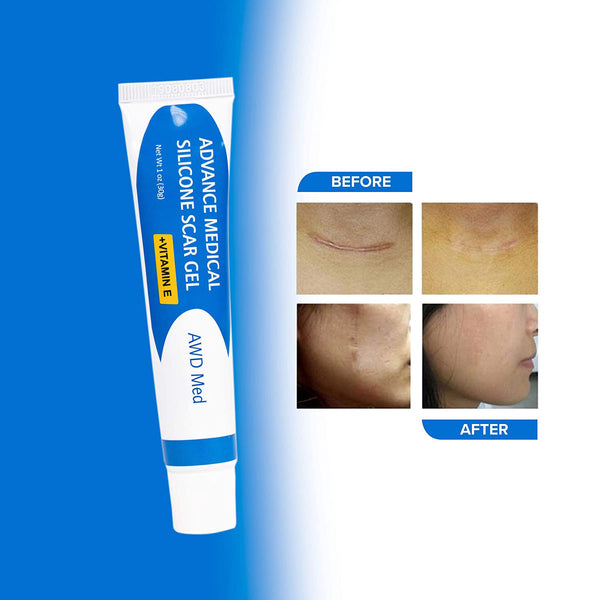 AWDMed Advance Medical Silicone Scar Gel - AWD Med