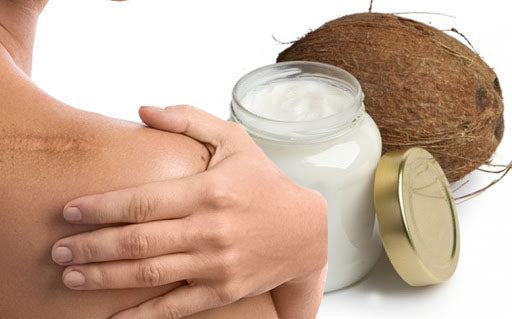 Coconut Oil and Scars: How to Use Coconut Oil for Different Types of Scars